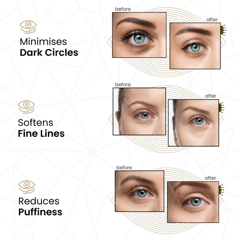 REVITALE 24k Gold Under Eye Collagen Patches, Reduce Puffy Eyes & Dark Circles, Illuminate Tired Eye Masks - Firms, Brightens, Energises (Packets - 30 Pair) - Image 3